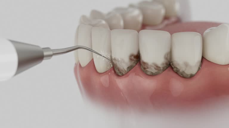 Reliable Teeth Cleaning And Checkup contractor in Sunflower County County, MS by Dentist Open Now